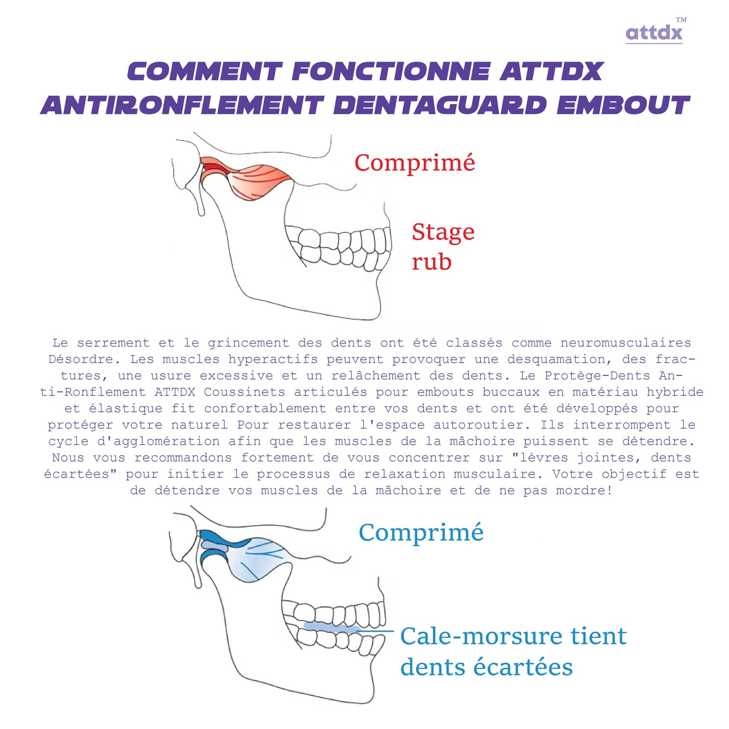 ATTDX Antironflement DentaGuard Embout