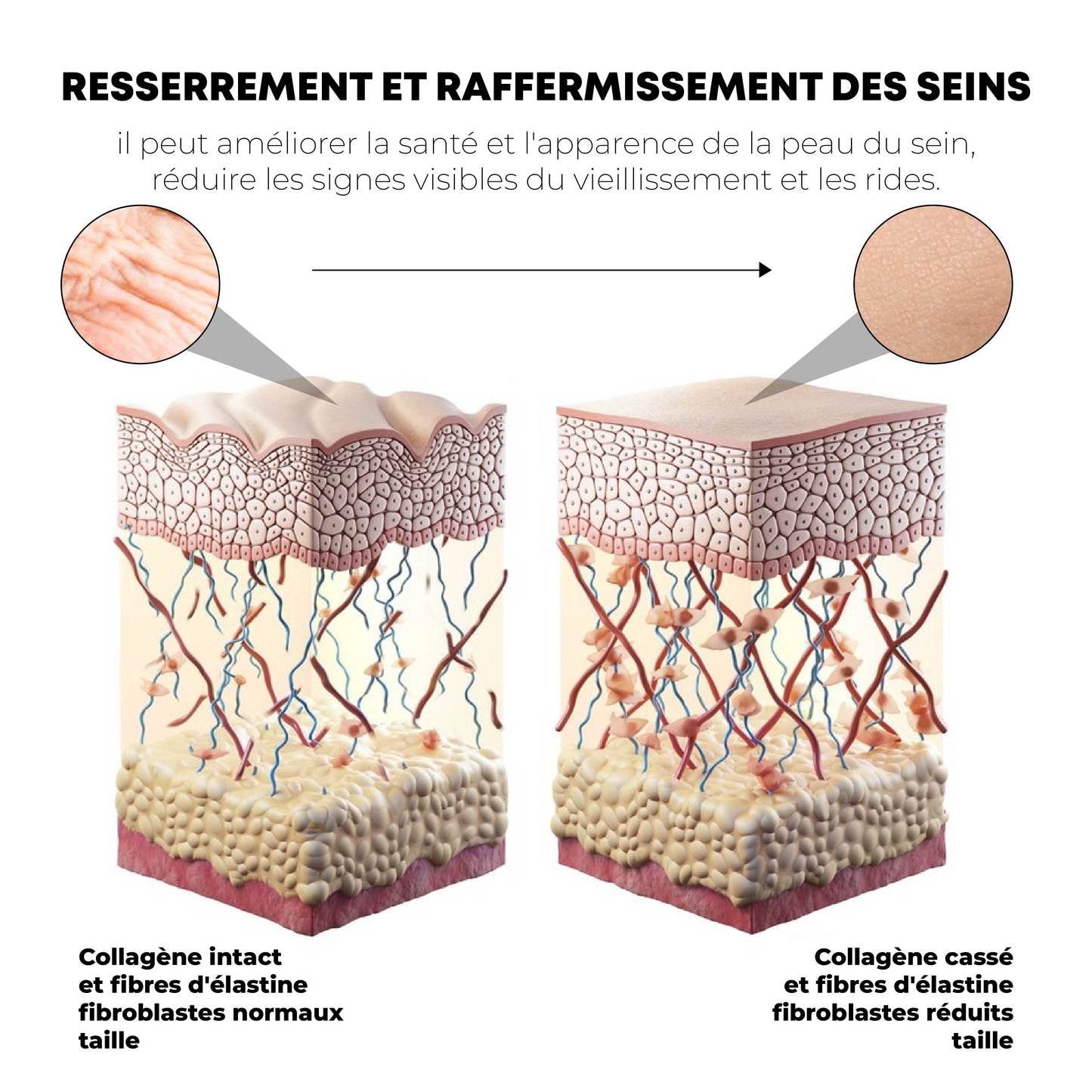 ATTDX SeinDodue Àbasedeplantes Renforcement Correctif