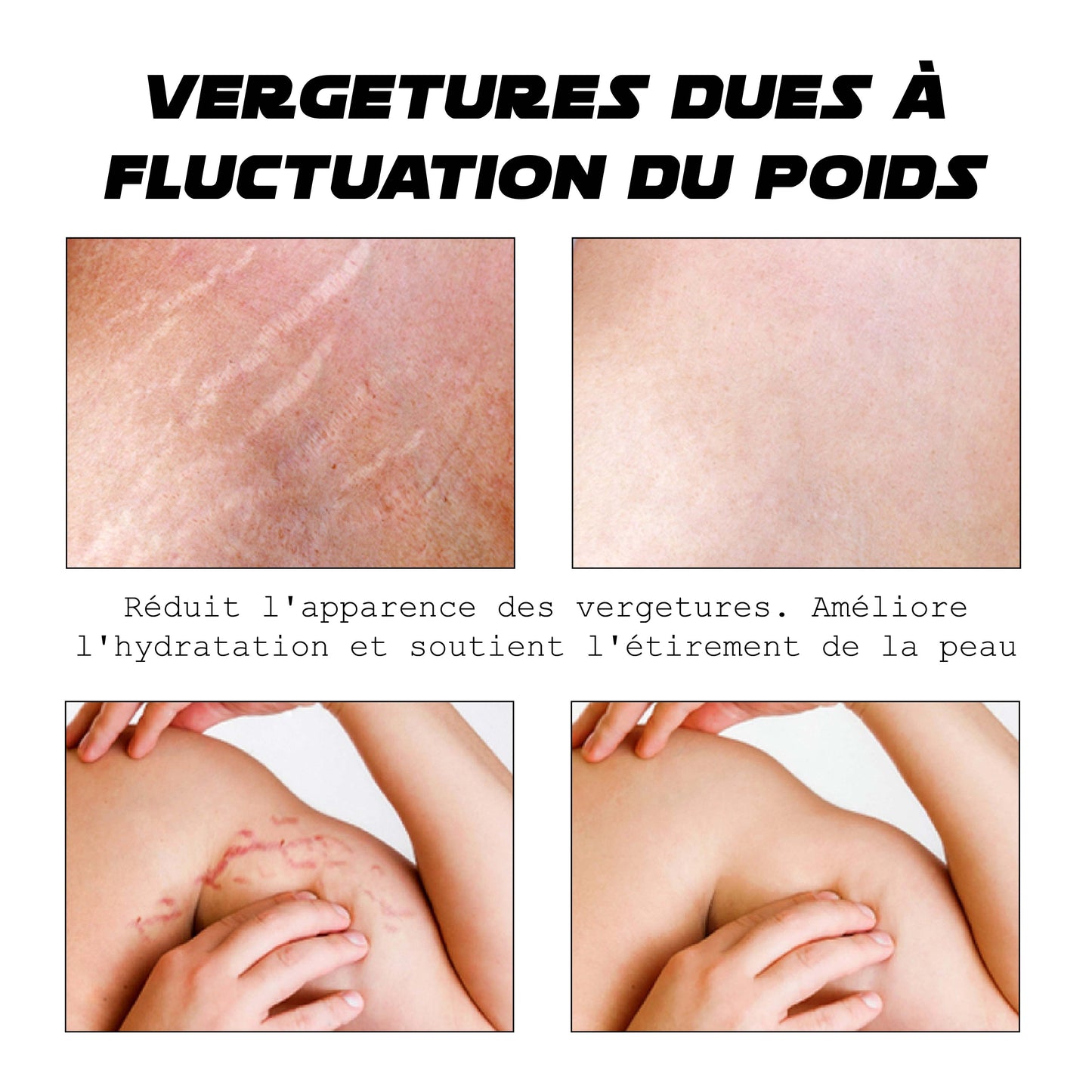 ATTDX CelluleBrûler PeauContraction Crème