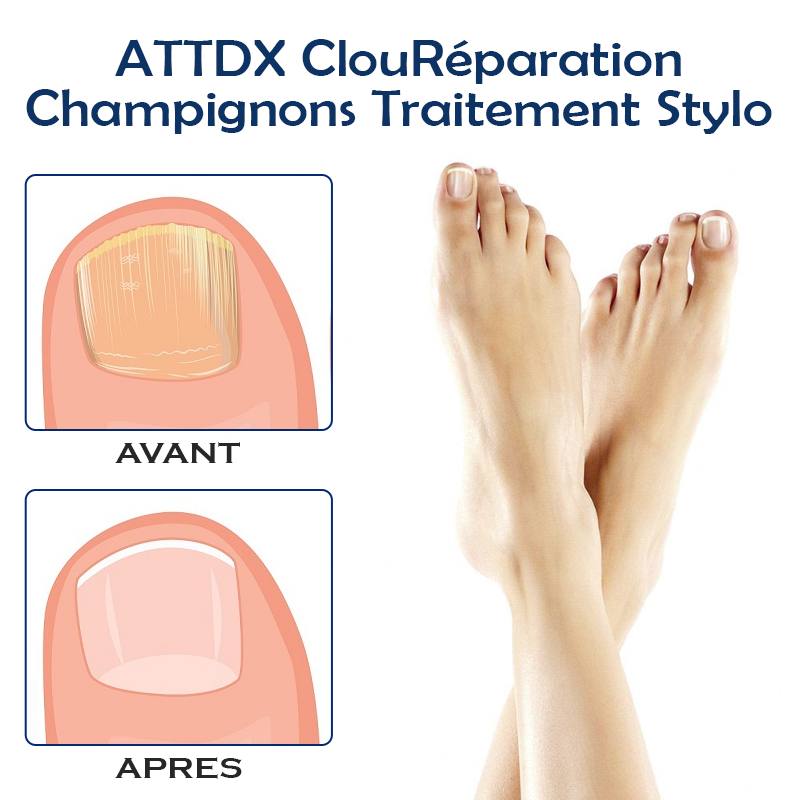 ATTDX ClouRéparation Champignons Traitement Stylo