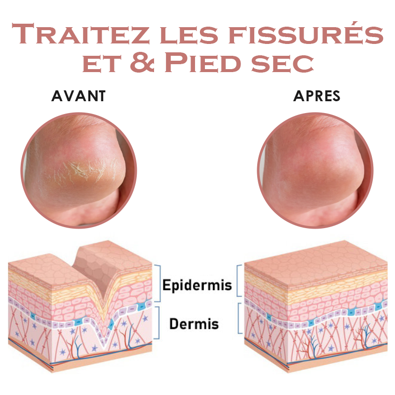 ATTDX Guérison des pieds Huile essentielle Comprimés pour le bain