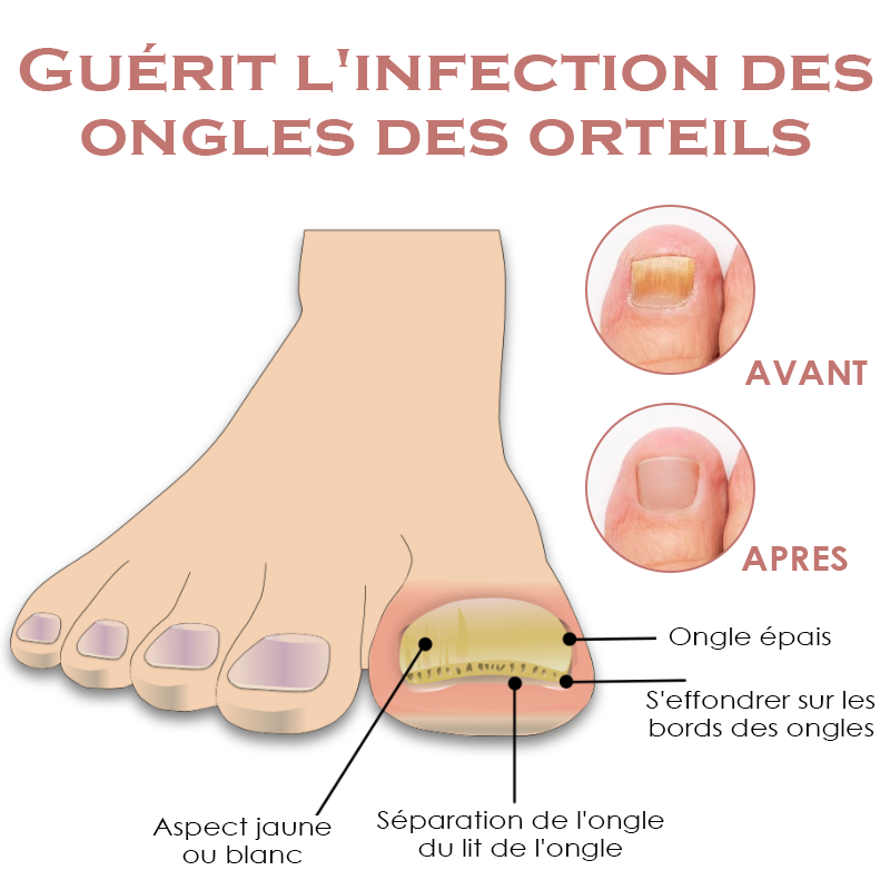 ATTDX Guérison des pieds Huile essentielle Comprimés pour le bain