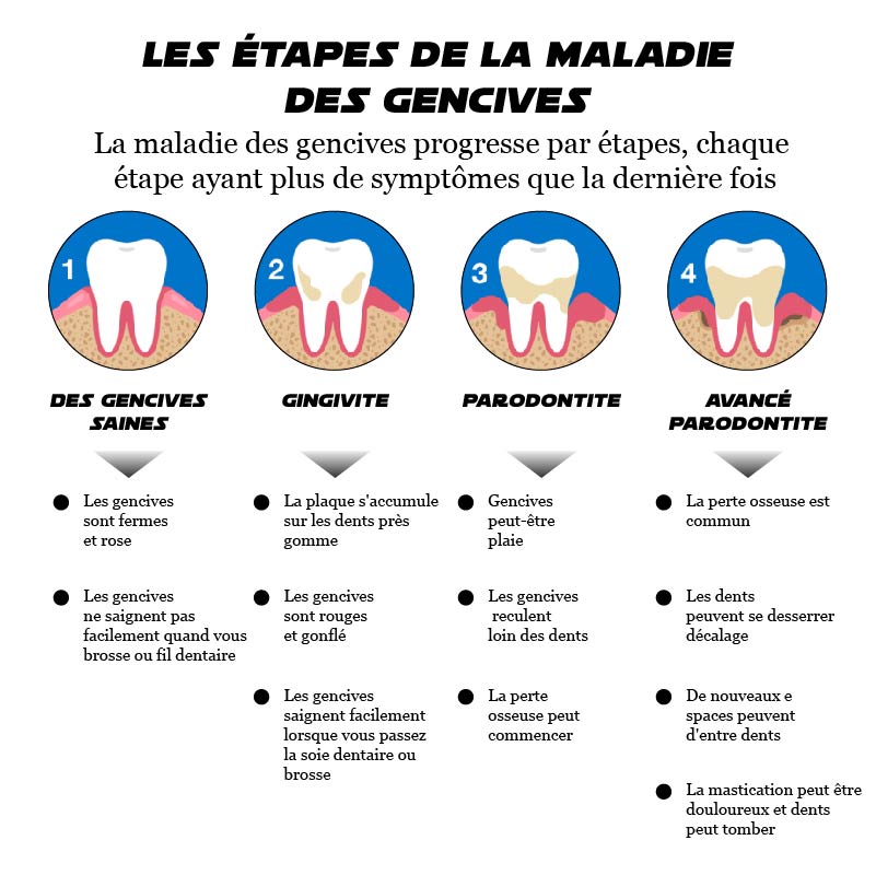 ATTDX GumRelève TraitementParodontal Gel