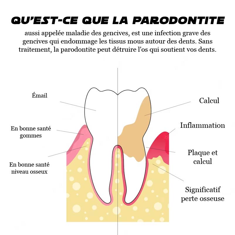 ATTDX GumRelève TraitementParodontal Gel