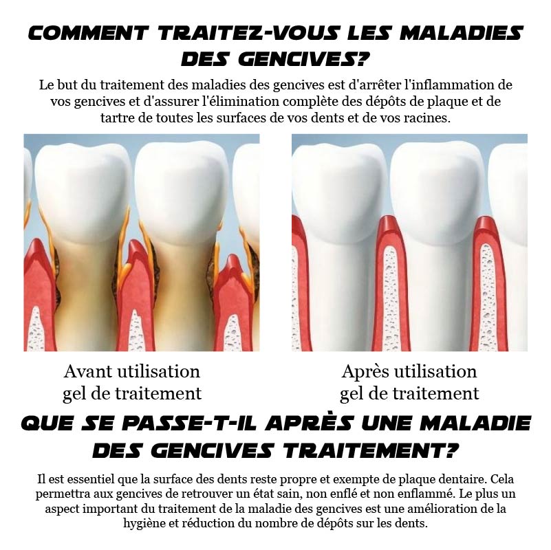 ATTDX GumRelève TraitementParodontal Gel