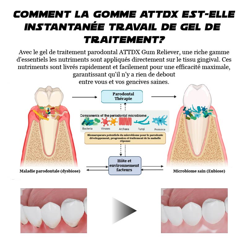 ATTDX GumRelève TraitementParodontal Gel