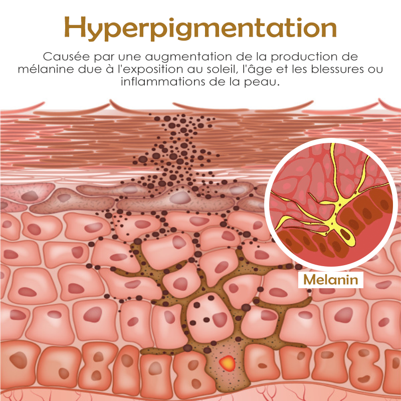 ATTDX CorpsBlanchiment SombrePlace Correctrice Crème