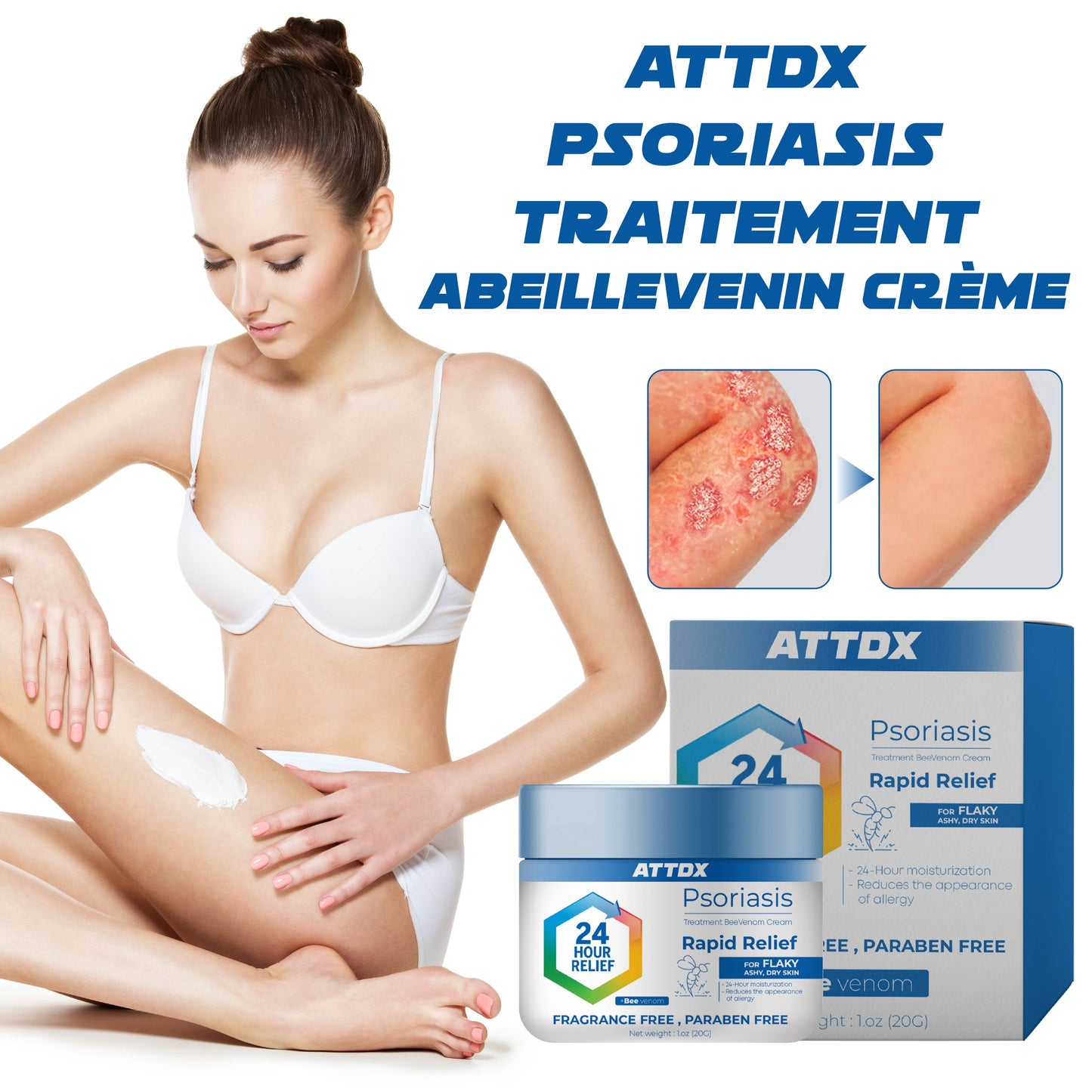 ATTDX Psoriasis Traitement AbeilleVenin Crème