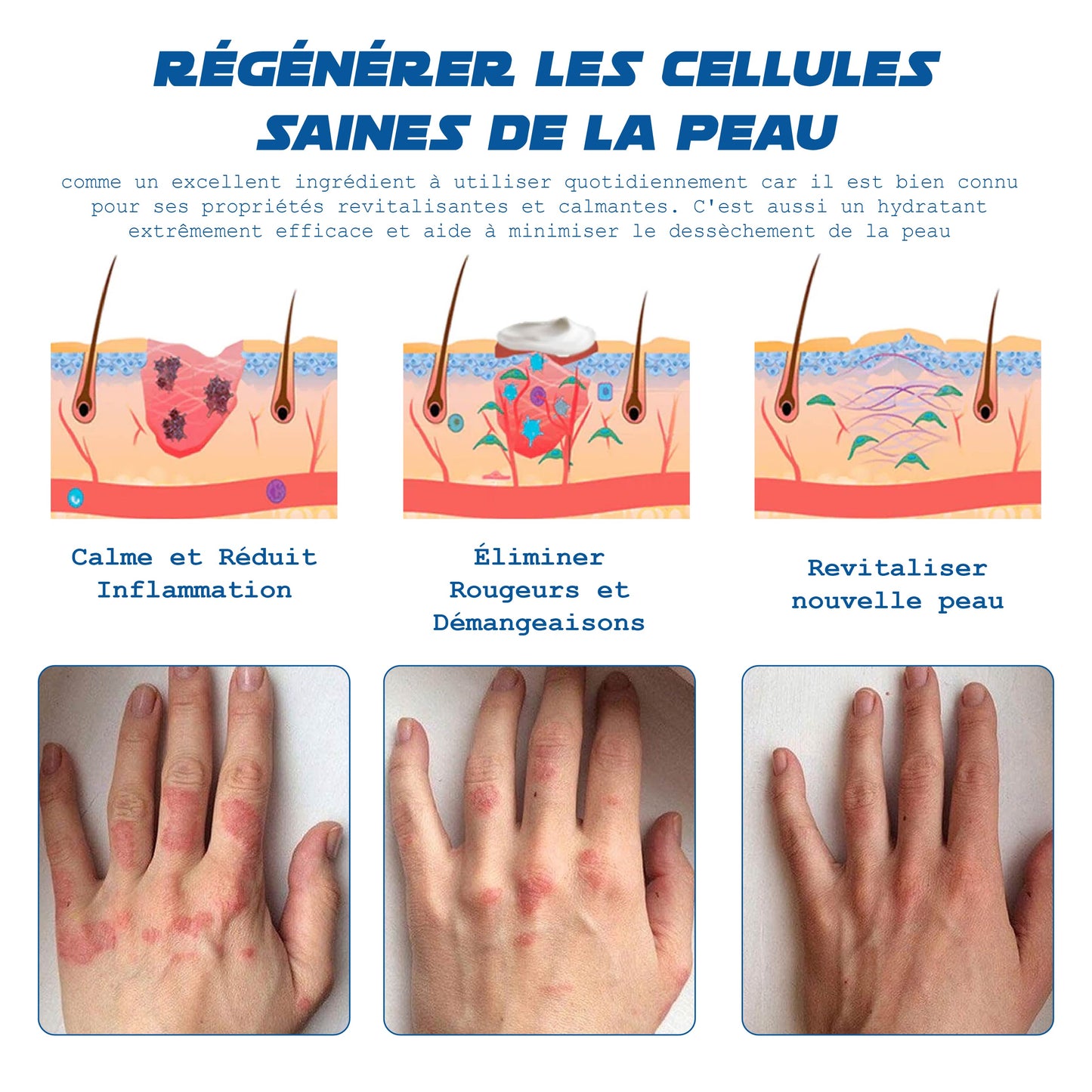 ATTDX Psoriasis Traitement AbeilleVenin Crème