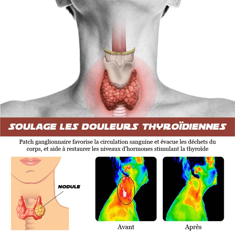ATTDX Thyroïde NoduleLymphatique Drainage Rustine