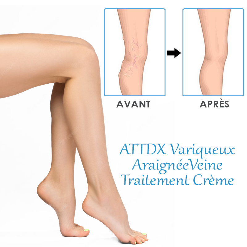 ATTDX Variqueux AraignéeVeine Traitement Crème