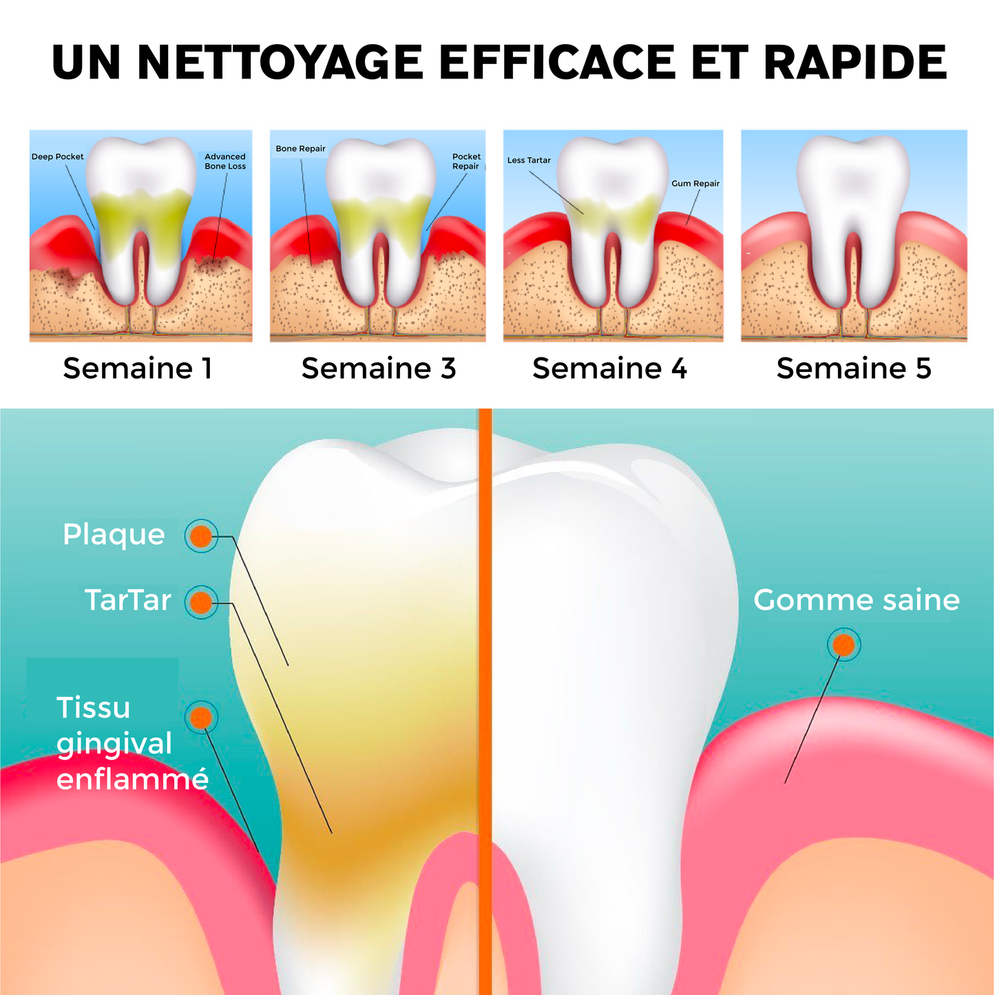 ATTDX Guérison orale Blanchiment des dents Rince bouche