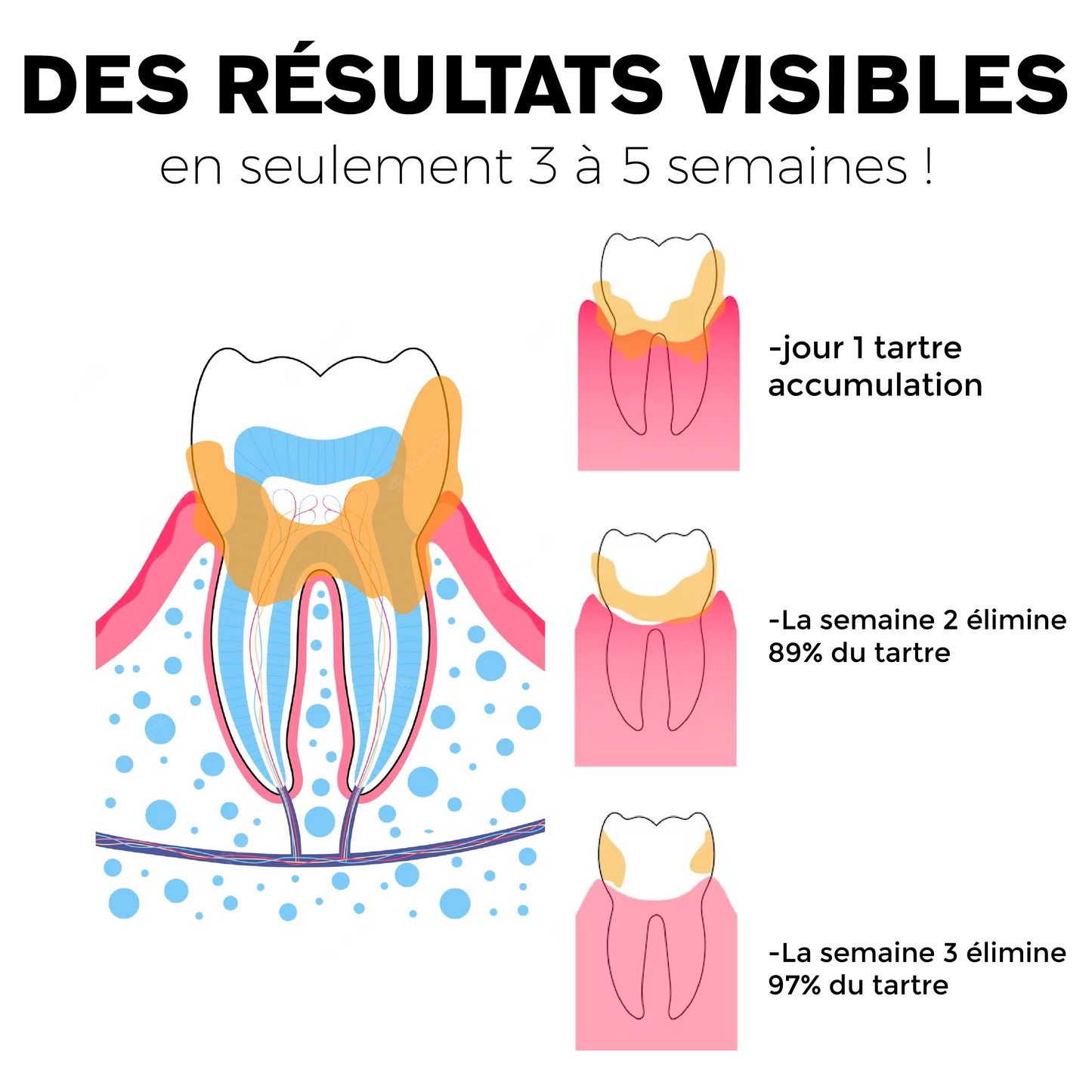 ATTDX Guérison orale Blanchiment des dents Rince bouche