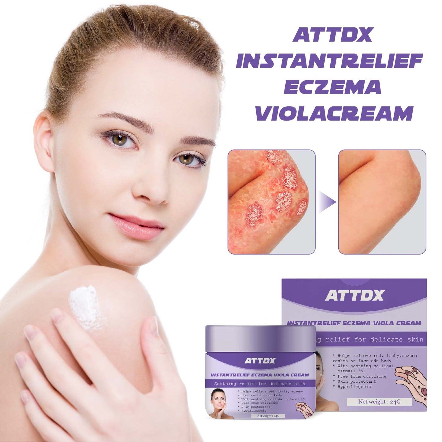 ATTDX SoulagementInstantané Eczéma Crème de violette